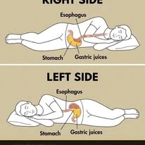 RIGHT SIDE Esophagus Stomach Gastric juices: The Details That Matter