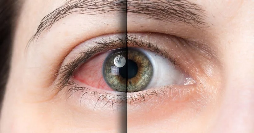 A Human Conversation: A Balanced Point of View, Seen with Better Context