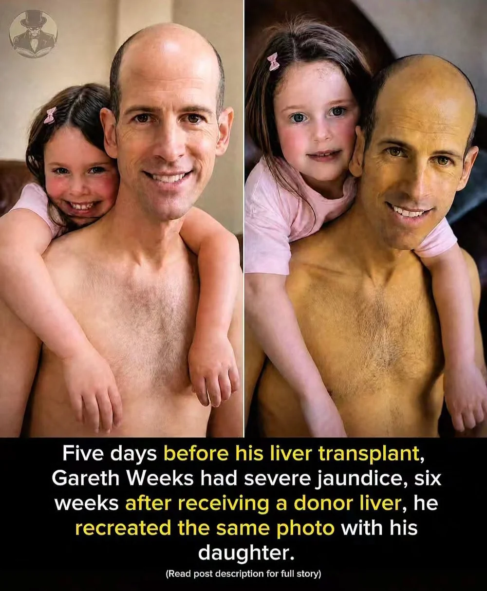 A Father Recreated a Family Photo After His Liver Transplant