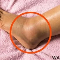 Understanding Acupuncture WARNING Without the Hype