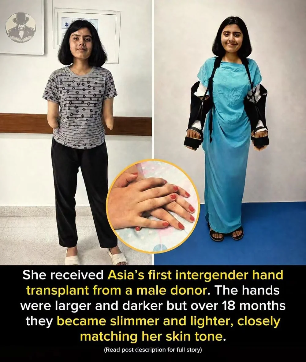 After a Double Transplant, Shreya Learned to Use Her Hands Again