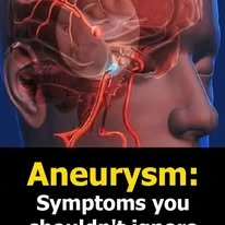 Aneurysm Symptoms you shouldn't ignore