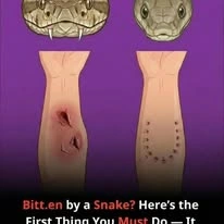 Bitten by a Snake? The First Thing You Do Could Save Your Life