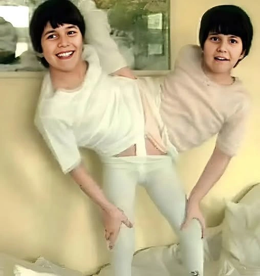 Born Joined at the Pelvis: Twins Share 3 Legs and Organs! Their Incredible Transformation After