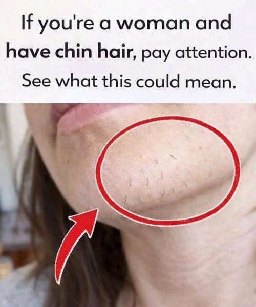 Chin Whiskers in Women .What They Really Mean and How to Manage Them FIND OUT MORE IN THE COMMENTS
