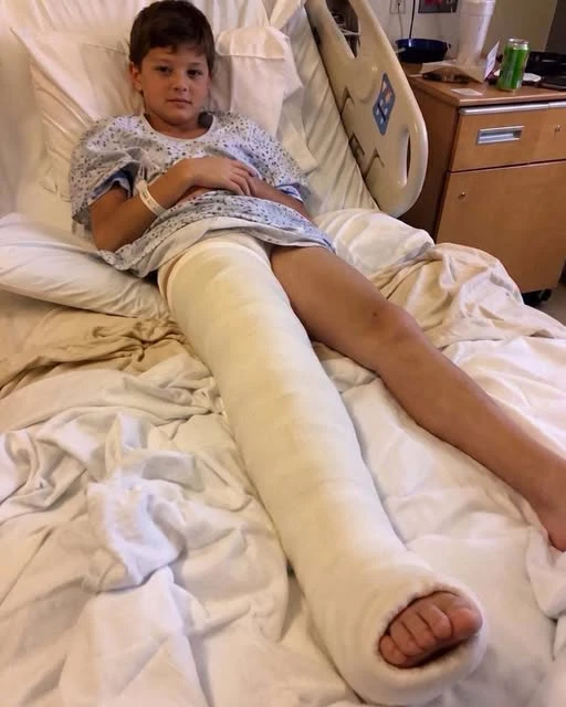 I went to the hospital to look after my son after he broke his leg