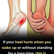 If your heel heel hurts when you wake up or without standing for a long time, th