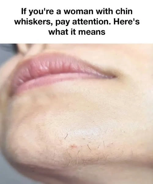 If you’re a woman with chin whiskers, pay attention. Here’s what it means