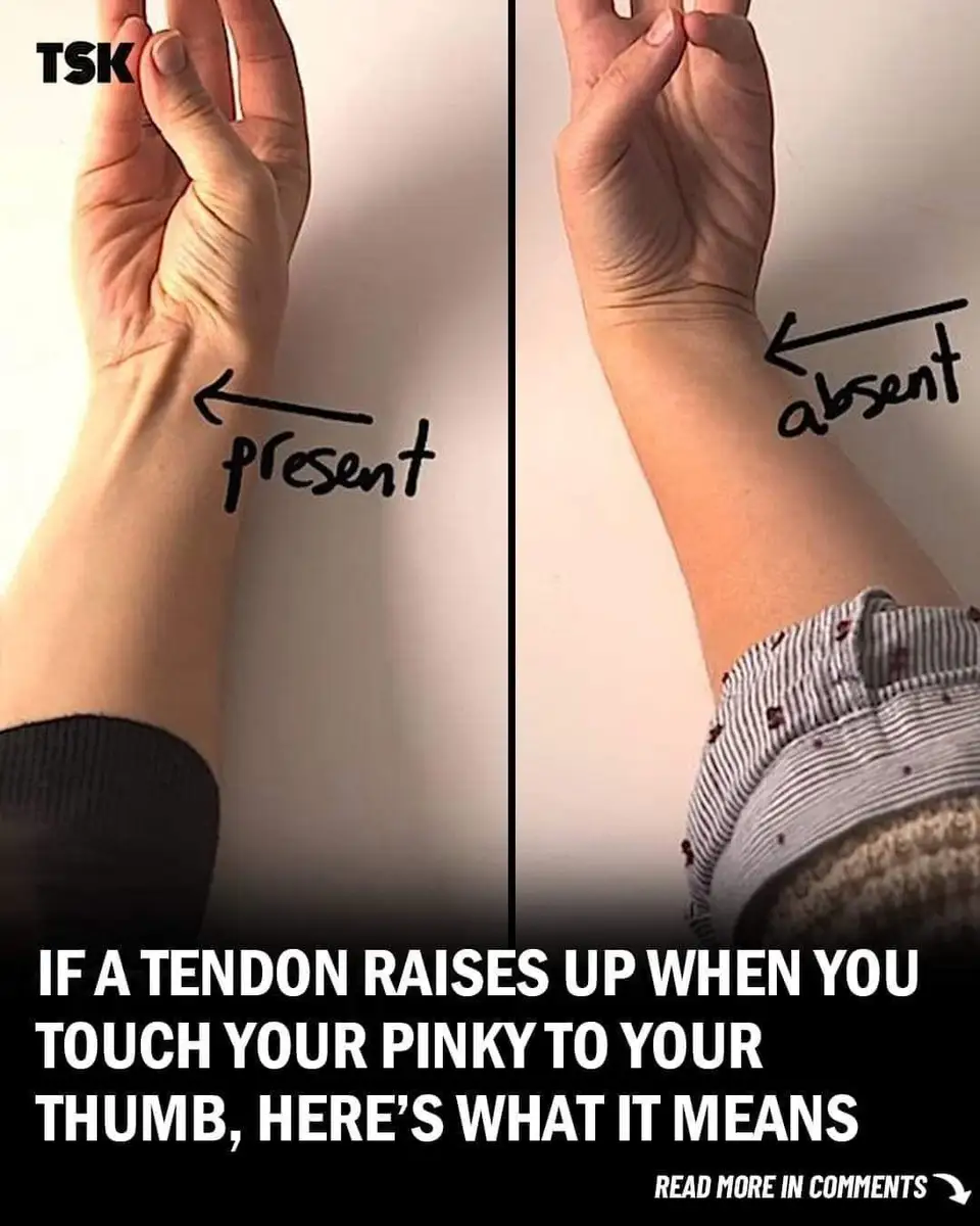 The Surprising Connection Between Your Tendon and Evolution - Story News