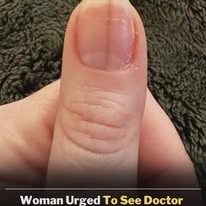 Woman Urged To See Doctor Immediately After Posting Concerning Photo Of Fingernail