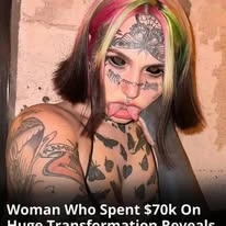 Woman Who Spent $70k On Huge Transformation Reveals What She Looked Like